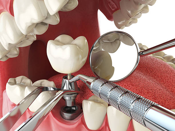Best Weekend Emergency Dentist in Trussville, AL